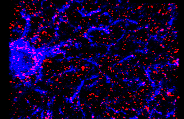 GFAP and SV2a imaging