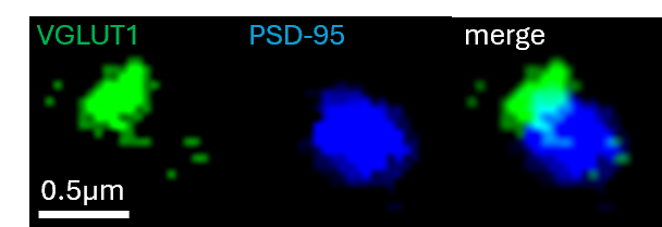 VGLUT1 and PSD-95 synaptic puncta