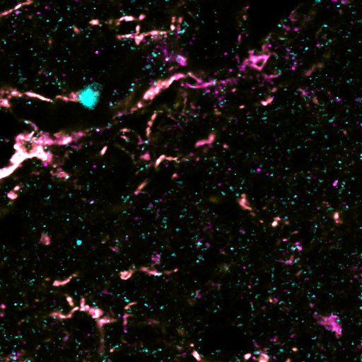 Ezrin confocal imaging