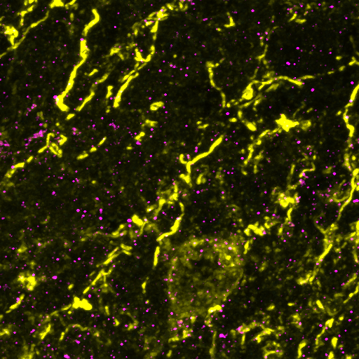 Ezrin and GFAP confocal imaging